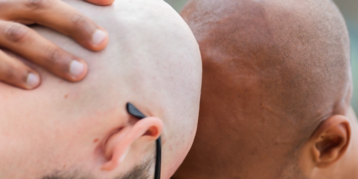 Aktienkursdiagramm, das den Anstieg von Biotech-Aktien im Zusammenhang mit Haarverlust-Behandlungen zeigt
